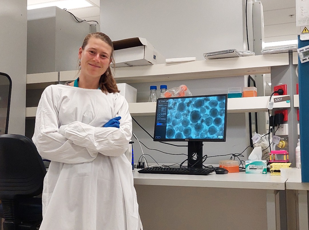 Lin in the lab in front of a cell imaging screen